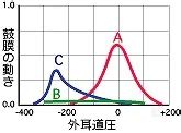 大阪の滲出性中耳炎の治療｜北東大阪耳鼻咽喉科 鼻・副鼻腔手術クリニック
