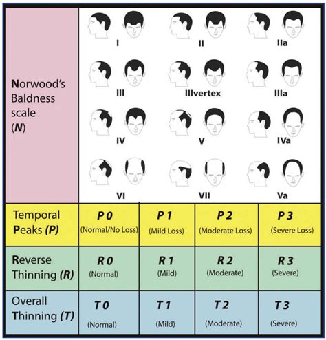 Retrograde Alopecia Symptoms Causes Treatments