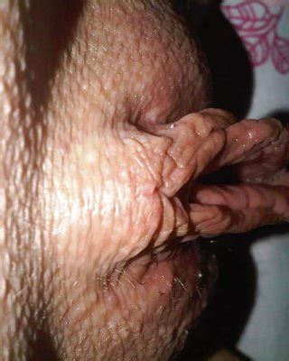 Labia Porn Pictures XXX Photos Sex Images PICTOA