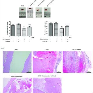 Effects Of Formononetin On Inflammatory Factors And Coagulation Factors