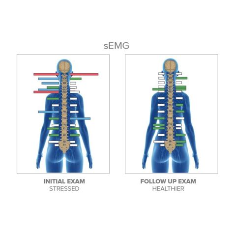 Advanced Chiropractic Technology Surface Emg Dody Chiropractic