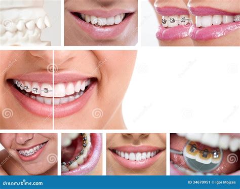 Bagues Dentaires Image Stock Image Du Bonheur Dentiste 34670951