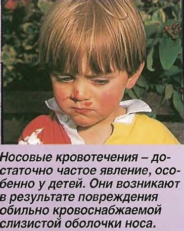 Структура носа и носовой полости (Анатомия человеческого тела) - Medsest.ru