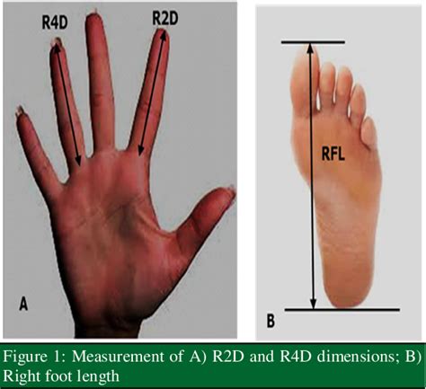 Estimation Of Stature From Hand And Foot Dimensions Of Annang Indigene