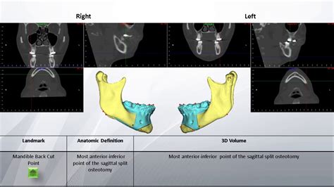 Craniofacial Radiological Landmarks 2019 YouTube