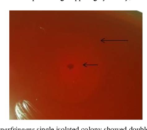 Table From Isolation Of Clostridium Perfringens From Fecal Samples Of