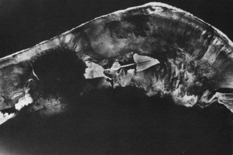 The Lingering Legacy Of Us Nuclear Testing In The Marshall Islands Nz