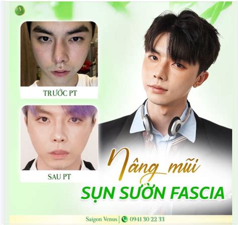 HOT TIKTOKER HƠN TR FOLLOW PHẠM TUẤN TÀI THAY ĐỔI SAU HƠN LẦN MŨI