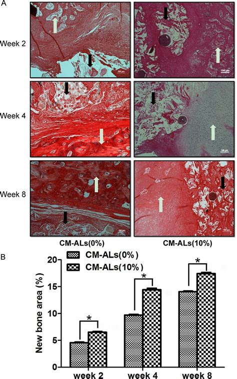 Histological Analysis Of Bone Regeneration And Scaffold Degradation At