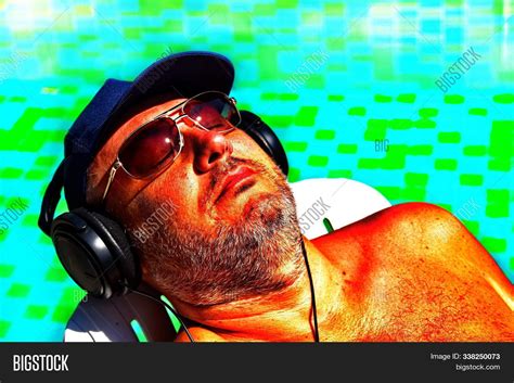 Sunburn On Skin Image And Photo Free Trial Bigstock