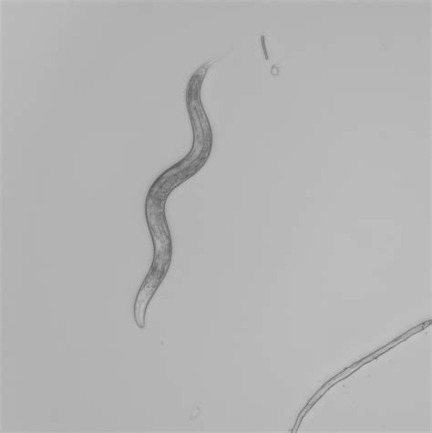 Segmentwormsautoscope1 Semantic Segmentation Dataset By Zimmerlab