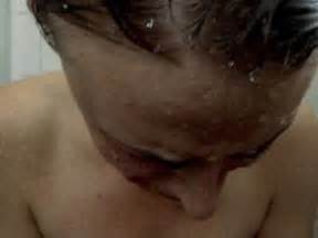 CHEMICAL PEEL NUDE SCENES AZNude