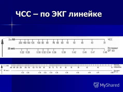 Экг Линейка Скачать - cricketcatalog