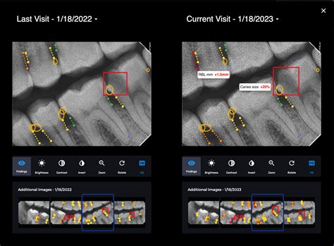 Dental Ai For Practices Videahealth