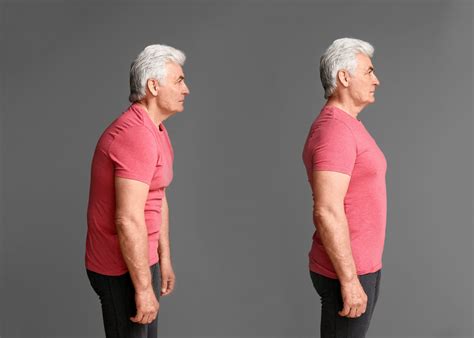 Shoulders Exercises To Improve Posture