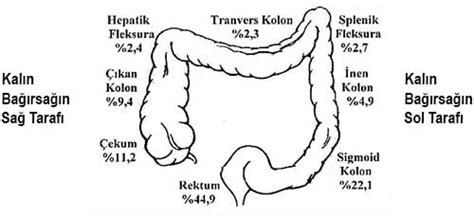 Kolon Kanseri Bağırsağın En Sık Hangi Bölgesinde Görülür