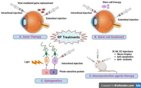 -Potential therapeutic modalities for retinitis pigmentosa. (a) Gene ...