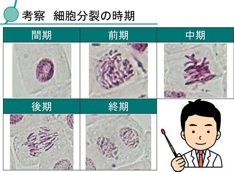 体細胞分裂の観察 | よっこん日記