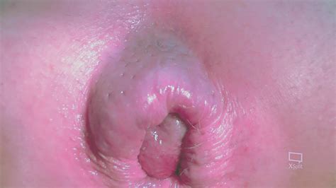 Swollen Asslips Clean Nude Pics XHamster