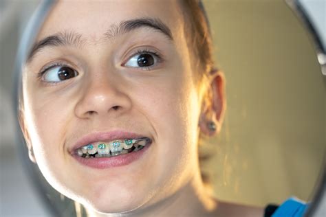 Can You Wear Wax on Braces While Sleeping? | Dental Chap