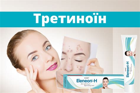 Третиноин - препарат, использование, противопоказания, эффекты