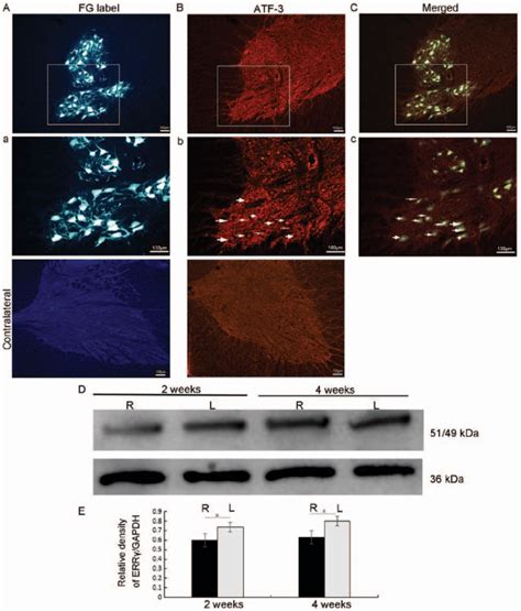 FG labeling and ATF 3 ERRγ in the injured spinal cord FG retrograde