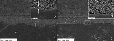 Representative SEM micrographs of the resin-enamel interfaces. SU in ...