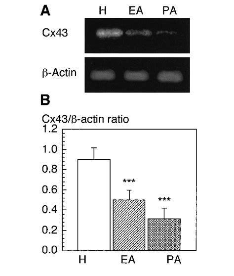 Changes In The Expression Of Connexin 43 Cx43 Protein In Granulosa