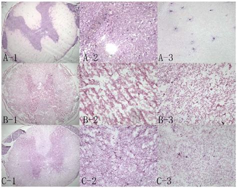 Hematoxylin And Eosin Staining In The Three Groups A Normal Spinal