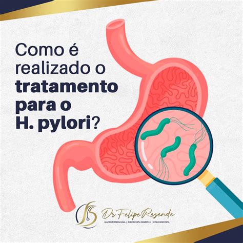 Dr Felipe Rezende Blog Como Realizado O Tratamento Para O H Pylori