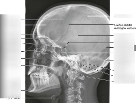 Skull Lateral Labeled Diagram Quizlet