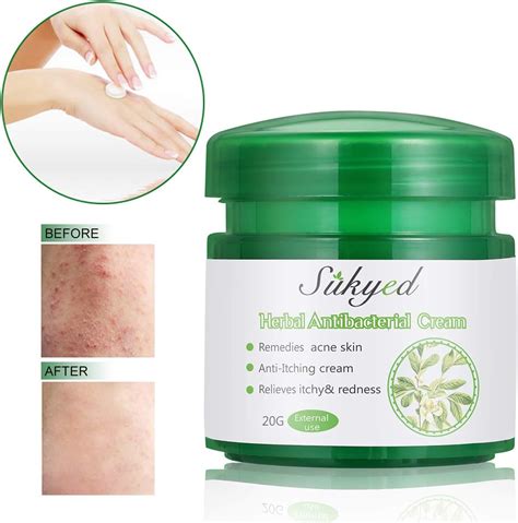 Natural Herbal Cream, Itch Relief Cream,Chinese Herbal Antibacterial ...