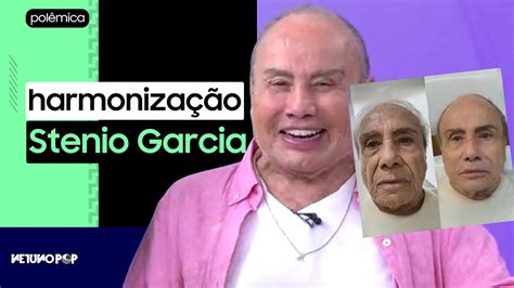 Stenio Garcia faz harmonização facial aos 91 e divide opiniões Esposa