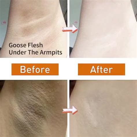 Private Parts Whitening Cream Underarm Whitening Nipples Bikini Whitening Cream G Remove