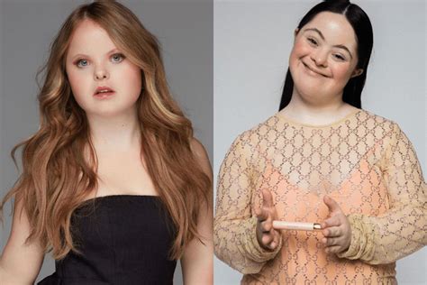 Modelle Con Sindrome Di Down Chi Sono Ellie Goldstein E Beth Matthews