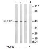 anti sirpb antibody ab abcam