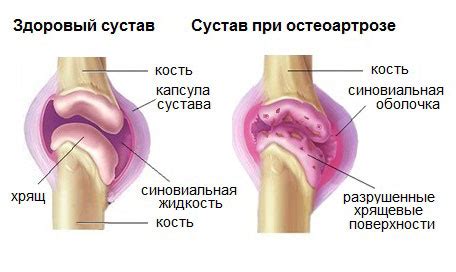 Дельта бад для суставов