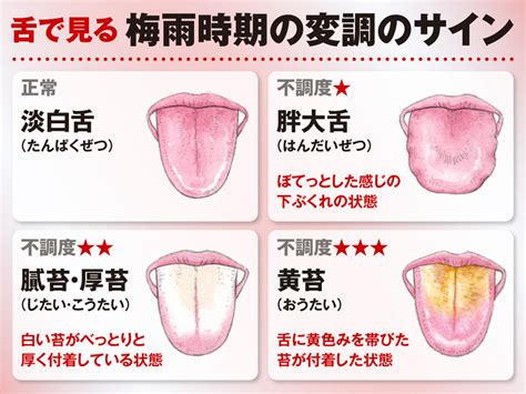 舌でわかる梅雨時期の変調のサインの見分け方 ウェザーニュース