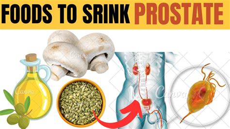 Top 10 Foods To Shrink An Enlarged Prostate Youtube