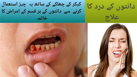 Danton Kay Dard Ka Ilaj Urdu Hindi Teeth Pain Treatment In Urdu By