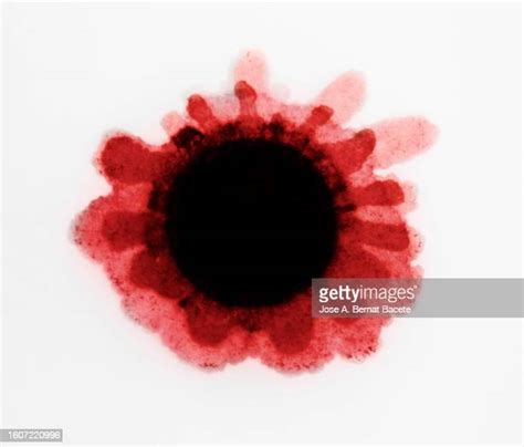 Entamoeba Histolytica Drawing Photos And Premium High Res Pictures Getty Images