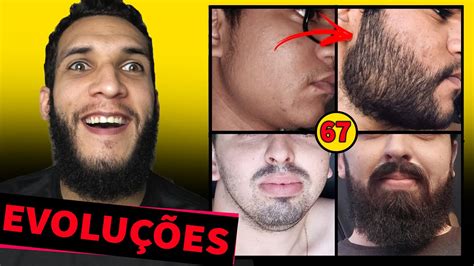 EVOLUÇÃO DOS INSCRITOS MINOXIDIL 67 YouTube