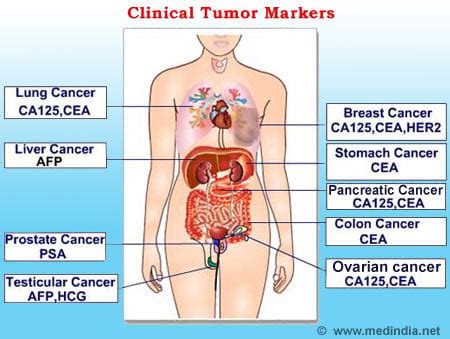 Infographic On Tumor Markers