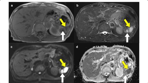 Magnetic Resonance Imaging Findings Magnetic Resonance Imaging Download Scientific Diagram