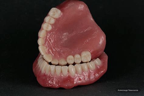 Четырехслойные зубы Anis Expert | «Компания «Анис-Дент»