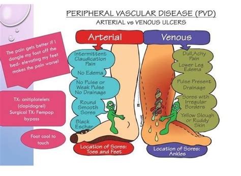 Arterial Ulcer Vs Venous Ulcer - ensleynBerber