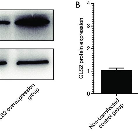 GLS2 protein expression in gastric cancer cell lines from the ...