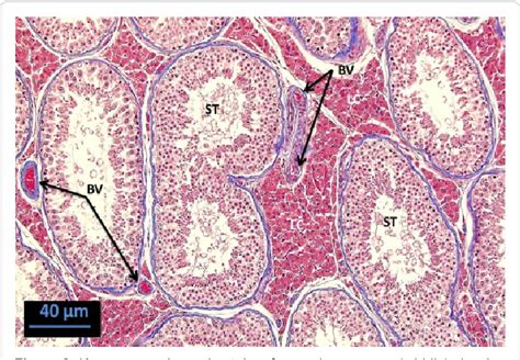 Testis Epididymis Histology