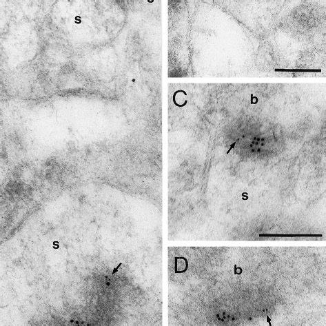 Double Immunogold Labeling Of NMDARs 10 Nm Particles And AMPARs 5 Nm