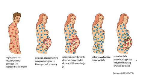 Konflikt Serologiczny W Ci Y Na Czym Polega Kiedy Wyst Puje I Czym